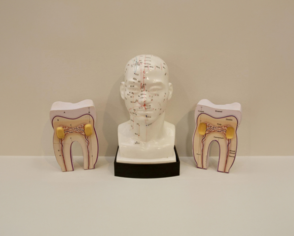 What Is Root Canal Therapy